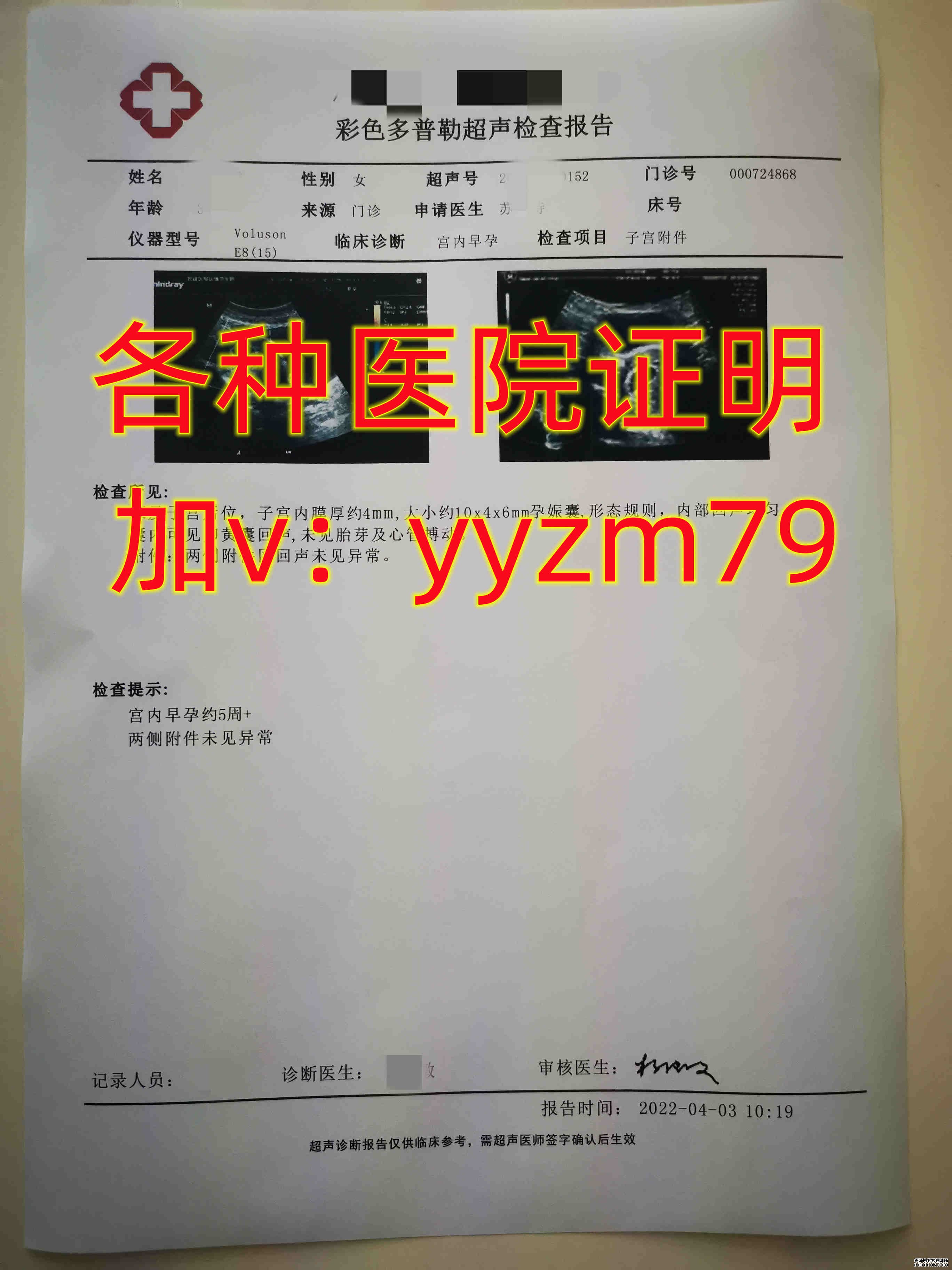 1 分钟读懂 B 超单，这几个指标，影响到你能否顺产 - 丁香园